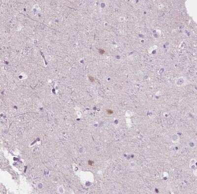 Immunohistochemistry-Paraffin: NOS1AP Antibody [NBP2-38151]