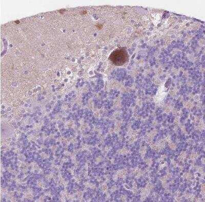 Immunohistochemistry-Paraffin: NOS1AP Antibody [NBP2-38151]