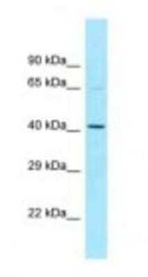 Western Blot: NOS1AP Antibody [NBP1-98487]