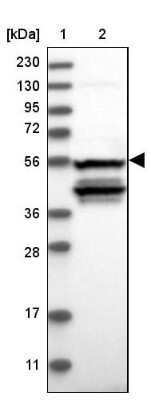 Western Blot: NOS1AP Antibody [NBP2-38151]