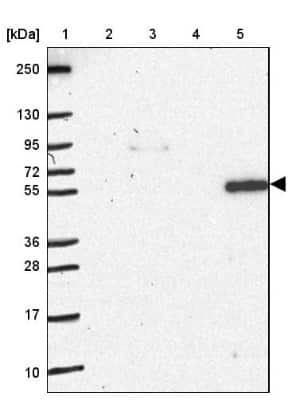 Western Blot: NOS1AP Antibody [NBP2-38758]