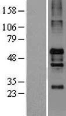 Western Blot: NOS1AP Overexpression Lysate [NBL1-13720]