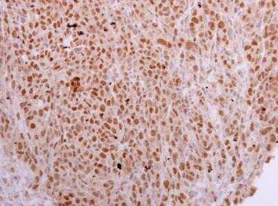 Immunohistochemistry-Paraffin: NOSIP Antibody [NBP2-19566]