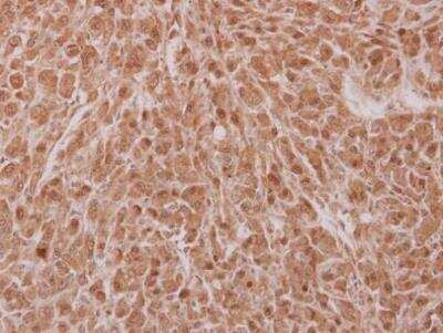 Immunohistochemistry-Paraffin: NOSIP Antibody [NBP2-19566]