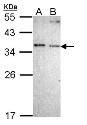 Western Blot: NOSIP Antibody [NBP1-31698]