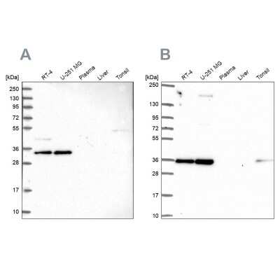 Western Blot: NOSIP Antibody [NBP1-85661]