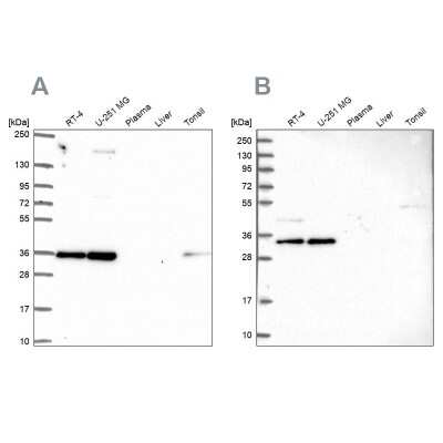 Western Blot: NOSIP Antibody [NBP2-55693]