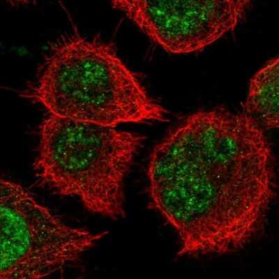 Immunocytochemistry/ Immunofluorescence: NOSTRIN Antibody [NBP2-13667]