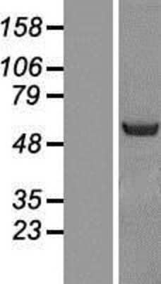 Western Blot: NOSTRIN Overexpression Lysate [NBL1-13724]