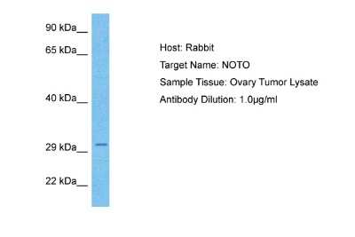 Western Blot: NOTO Antibody [NBP2-83288]