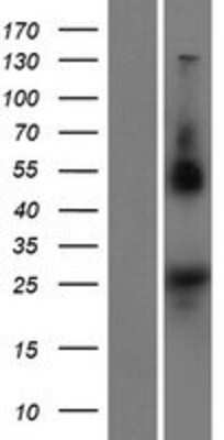 Western Blot: NOTO Overexpression Lysate [NBP2-09547]