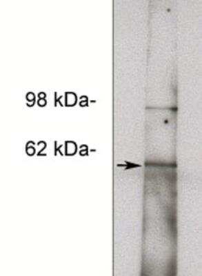 Western Blot: NOTUM Antibody [NBP2-66631]