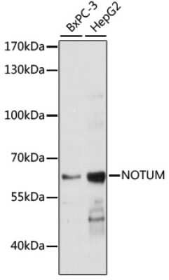 Western Blot: NOTUM AntibodyAzide and BSA Free [NBP2-94699]