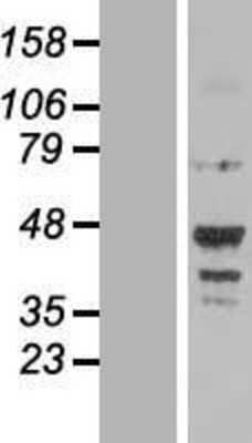 Western Blot: NOTUM Overexpression Lysate [NBL1-13728]