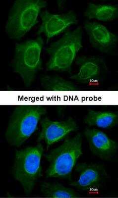 Immunocytochemistry/ Immunofluorescence: NOV/CCN3 Antibody [NBP1-31416]