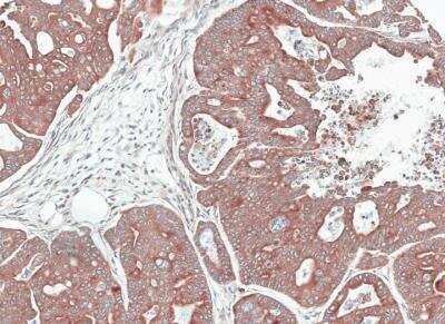 Immunohistochemistry-Paraffin: NOV/CCN3 Antibody [NBP1-31416]