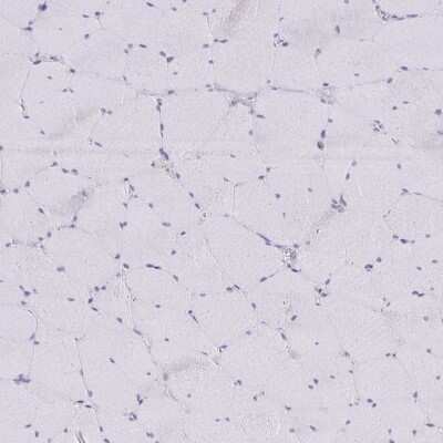Immunohistochemistry-Paraffin: NOV/CCN3 Antibody [NBP1-88154]
