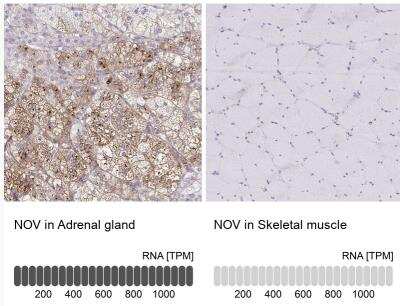 Immunohistochemistry-Paraffin: NOV/CCN3 Antibody [NBP1-88154]