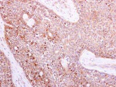 Immunohistochemistry-Paraffin: NOX1 Antibody [NBP1-31546]