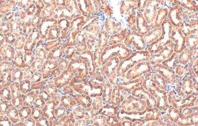 Immunohistochemistry-Paraffin: NOX1 Antibody [NBP1-31546]