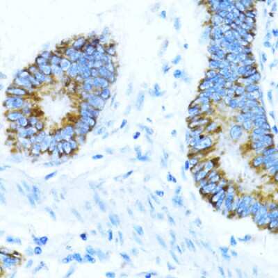 Immunohistochemistry-Paraffin: NOX1 Antibody - Azide and BSA Free [NBP2-93835]