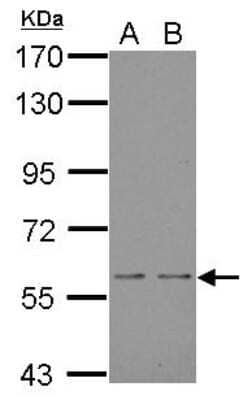 Western Blot: NOX1 Antibody [NBP1-31546]