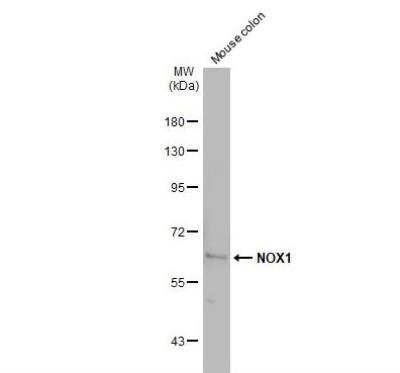 Western Blot: NOX1 Antibody [NBP1-31546]