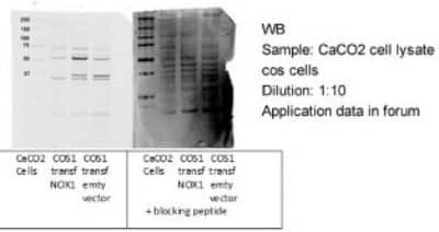 Western Blot: NOX1 Antibody [NBP1-69573]