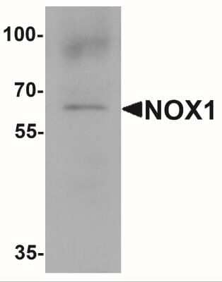 Western Blot: NOX1 AntibodyBSA Free [NBP2-41290]