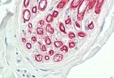 Immunohistochemistry-Paraffin: NOX3 Antibody [NBP2-84190]