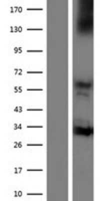 Western Blot: NOX3 Overexpression Lysate [NBP2-07120]