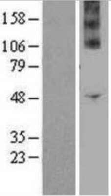 Western Blot: Nox4 Overexpression Lysate [NBP2-04362]