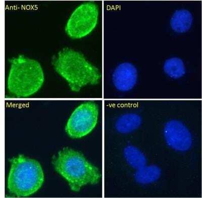 Immunocytochemistry/ Immunofluorescence: NOX5 Antibody [NBP1-68862]