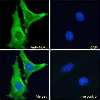 Immunocytochemistry/ Immunofluorescence: NOX5 Antibody [NBP1-68862]