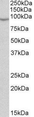 Western Blot: NOX5 Antibody [NBP1-68862]