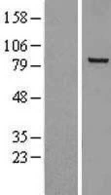 Western Blot: NOX5 Overexpression Lysate [NBL1-13733]