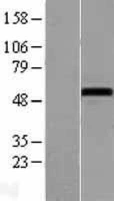 Western Blot: NOXA1 Overexpression Lysate [NBL1-13734]