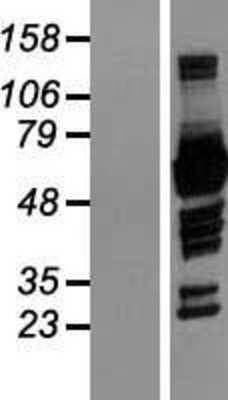 Western Blot: p67phox/NOXA2 Overexpression Lysate [NBL1-13510]