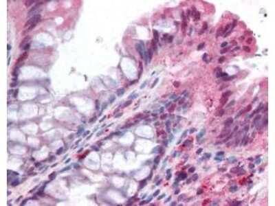 Immunohistochemistry: NOXO1 Antibody [NBP1-77899]