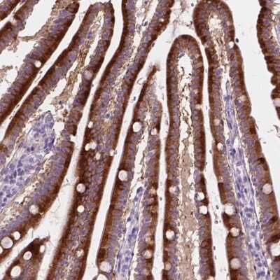 Immunohistochemistry-Paraffin: NOXO1 Antibody [NBP2-49663]