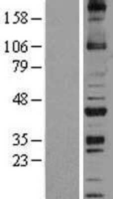 Western Blot: NOXO1 Overexpression Lysate [NBL1-13735]