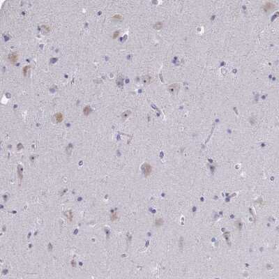 Immunohistochemistry-Paraffin: NOXRED1 Antibody [NBP2-33761]