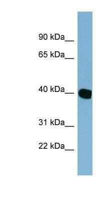 Western Blot: NOXRED1 Antibody [NBP1-70434]