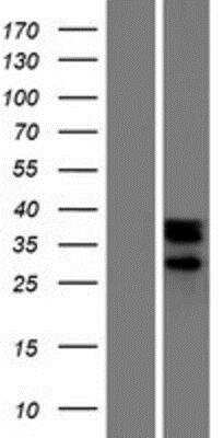 Western Blot: NOXRED1 Overexpression Lysate [NBP2-05601]