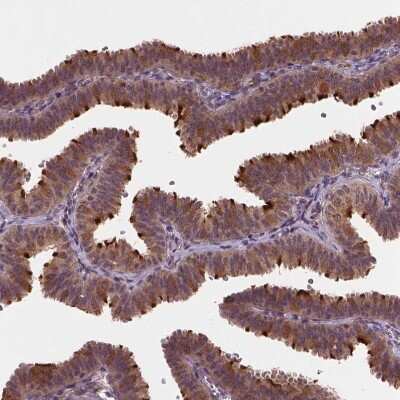 Immunohistochemistry-Paraffin: NPAL2 Antibody [NBP2-49667]