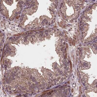 Immunohistochemistry-Paraffin: NPAL2 Antibody [NBP2-49667]