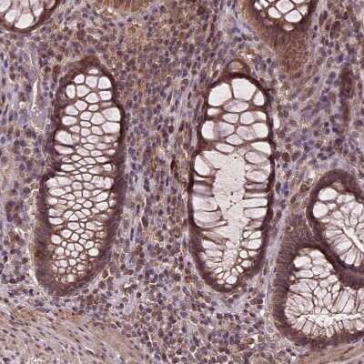 Immunohistochemistry-Paraffin: NPAL2 Antibody [NBP2-49667]