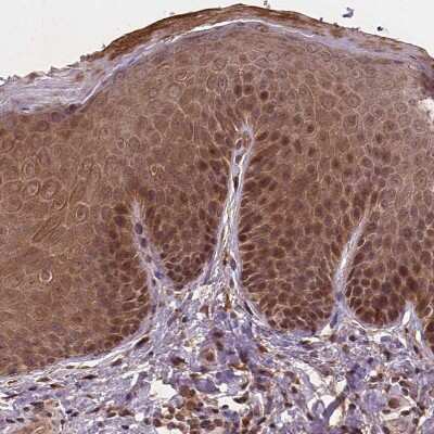 Immunohistochemistry-Paraffin: NPAL2 Antibody [NBP2-49667]