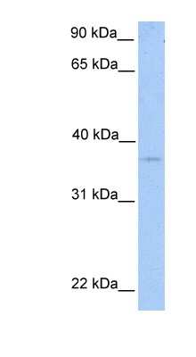 Western Blot: NPAL2 Antibody [NBP1-70656]