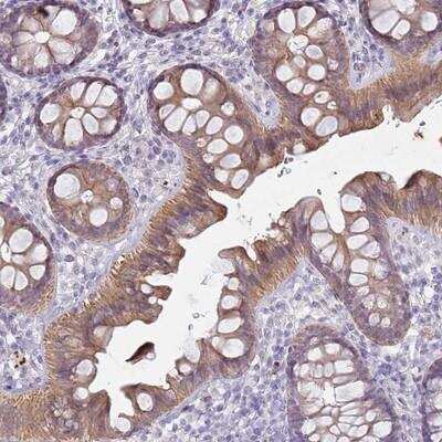 Immunohistochemistry: NPAP1 Antibody [NBP2-14377]